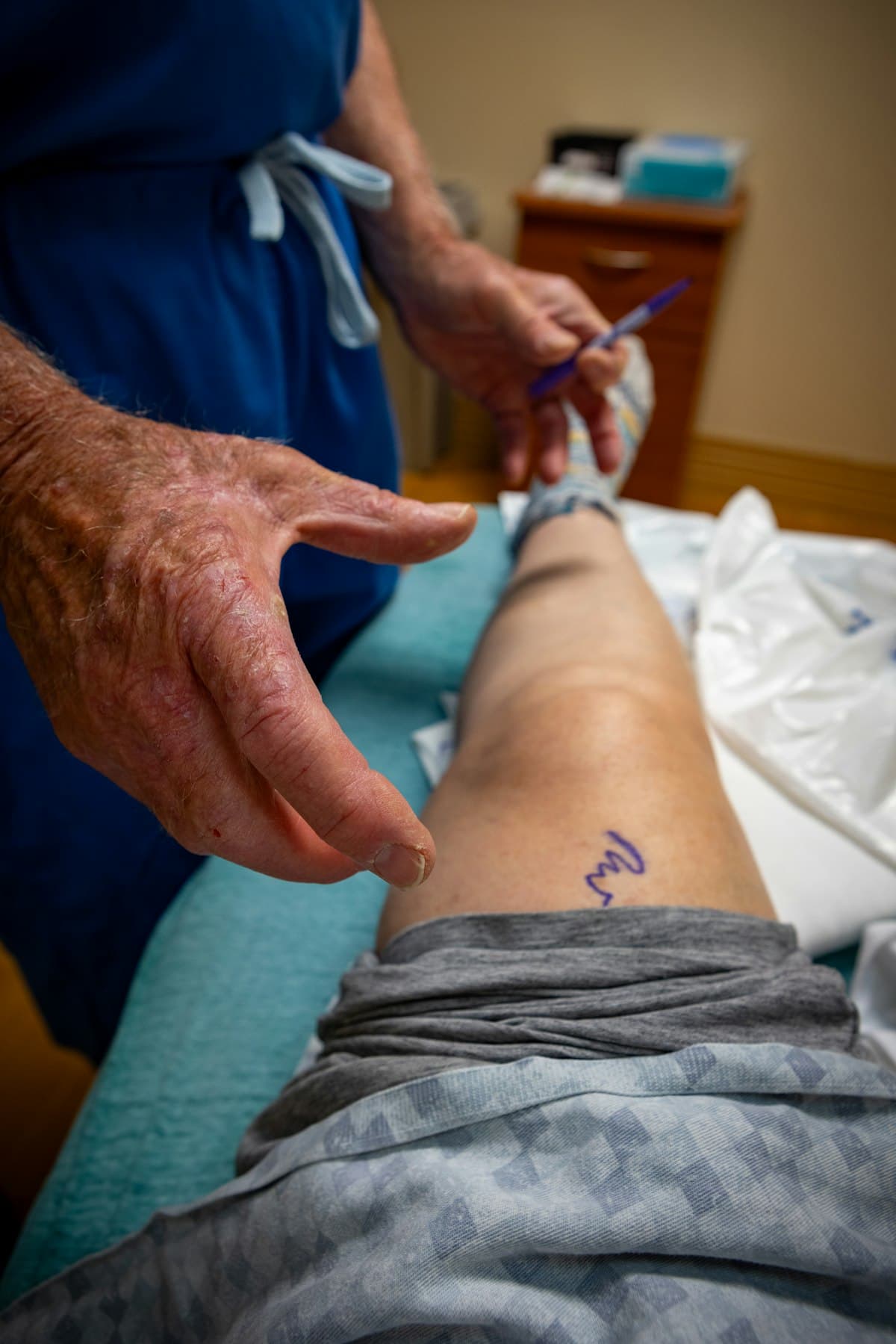 Pubalgia no Corredor: Sinais e Tratamento